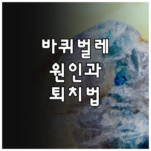 우리 집 바퀴벌레, 왜? 종류와 퇴치법, 완벽 예방 전략 공개