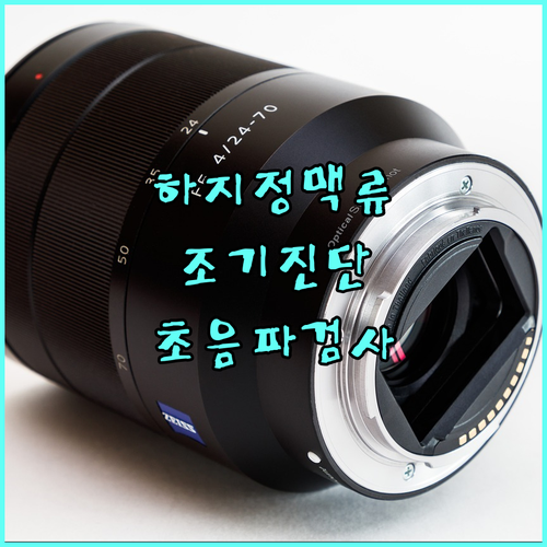 놓치면 안될, 하지정맥류 조기 진단과 초음파 검사