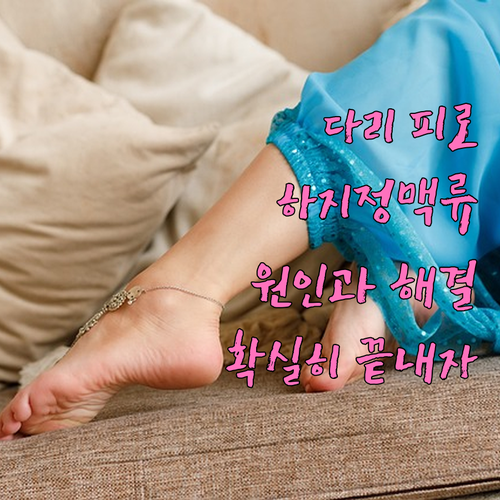 하지정맥류로 인한 피로, 해결 방법은?