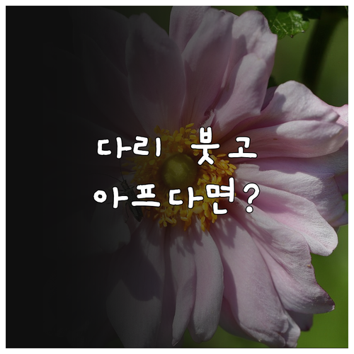 퇴근 후 다리 붓고 아프다면? 하지정맥류 예방 및 관리법