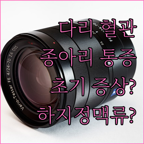 다리 혈관 튀어나옴과 종아리 통증, 하지정맥류 초기 증상?