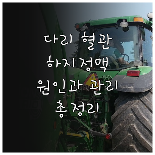 하지정맥류 치료의 모든 것, 원인부터 관리까지 상세 안내