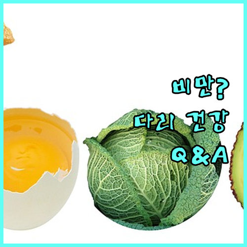 비만과 하지정맥류 궁금증 해결 다리 건강 Q&A