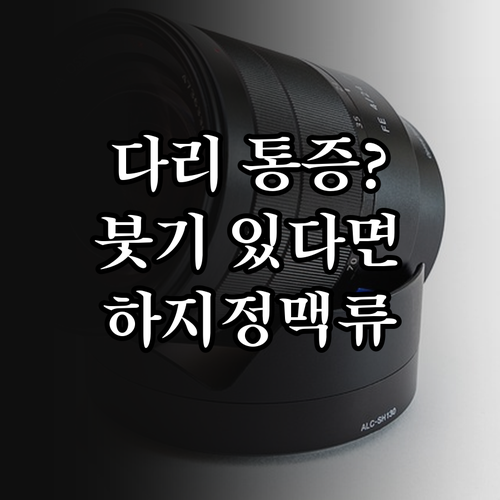 다리 통증, 붓기 방치하면 큰일! 하지정맥류 초기 진단
