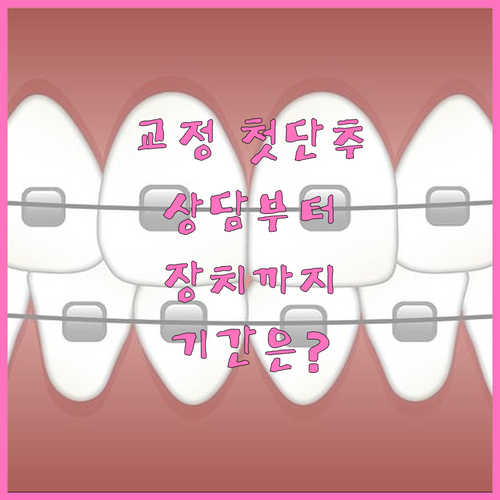 치아교정 첫 단추, 상담부터 장치 부착까지 기간 한눈에 보기