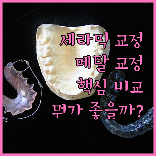 교정 종류 선택 가이드: 세라믹 vs 메탈 핵심 비교