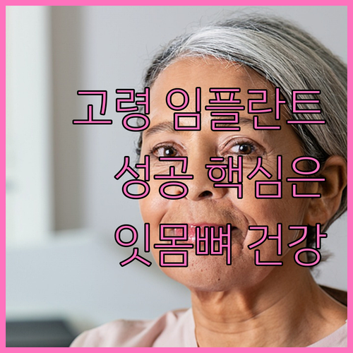 고령 임플란트 성공 핵심, 잇몸뼈와 건강 상태 집중 분석