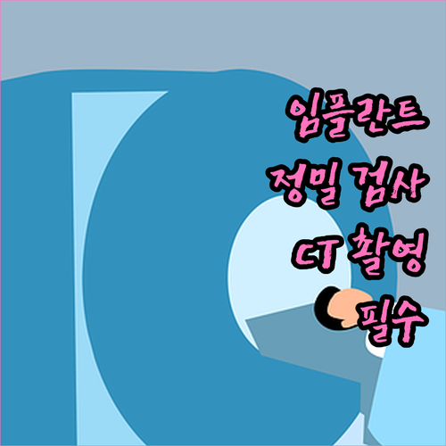 임플란트, 정밀 검사로 안전하게: CT 촬영의 중요성